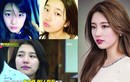 Suzy bị “tố” phẫu thuật thẩm mỹ nhiều lần