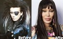 Pete Burns thay đổi thế nào sau 300 lần phẫu thuật thẩm mỹ?