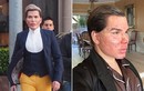 Rodrigo Alves phá nát mặt vì muốn làm búp bê sống Ken