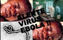 Tiết lộ bất ngờ về tên gọi virus Ebola 