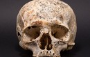 Rùng mình thi hài 4.000 tuổi có hộp sọ kỳ quái