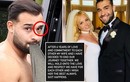 Chồng của Britney bị... đấm tím mắt khi đang nằm ngủ bên vợ?