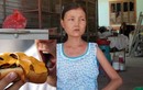 Tác hại khủng khiếp bệnh ăn uống vô độ của cô gái Quảng Nam
