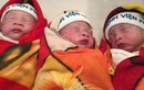 Cực hiếm 3 bé sinh ba chào đời nguyên bọc ối ở VN