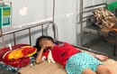 Bé gái nguy kịch vì mua nước ở cổng trường bị đưa nhầm chai axit