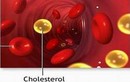 Vì sao người Việt ăn ít chất béo nhưng lại thừa cholesterol? 