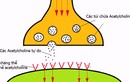 Bệnh nhược cơ là gì, có phải là không thể chữa được?