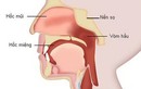 Dấu hiệu phát hiện ung thư cổ họng sớm