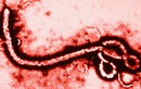 Lý giải nhiều bệnh nhân thoát chết khi nhiễm Ebola