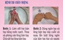 Hướng dẫn phòng bệnh tay chân miệng bằng hình ảnh