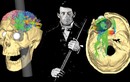 Phineas Gage và vụ tai nạn khai sinh ra khoa học thần kinh hiện đại