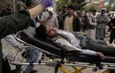 Liên hợp quốc lên án vụ tấn công gây nhiều thương vong tại Kabul