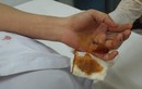 Truy sát trong bệnh viện, nữ điều dưỡng bị đâm thủng tay