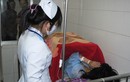 Nữ sinh viên Đà Lạt bị xăng thiêu cháy ngực
