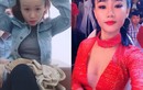 1001 nỗi khổ bất tận của girl xinh sở hữu vầng trán sân bay "lồng lộng"