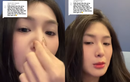 Nóng nhất lúc này: Quỳnh Alee lên video chứng minh nhan sắc "hàng real"