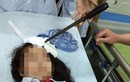 Vụ học sinh bị phi dao trúng đầu ở Hà Nam: Bộ GD&ĐT chỉ đạo “nóng“