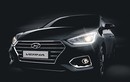 "Soi" xe Hyundai Verna máy dầu giá chỉ từ 297 triệu 