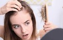Sai lầm cơ bản khiến tóc rụng và xấu đi mỗi ngày