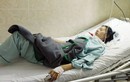 Bệnh nhân yếu liệt cả tháng mới được phát hiện ngộ độc pate Minh Chay