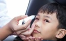 Triệu chứng đau mắt đỏ phổ biến ở trẻ