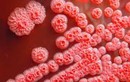 Những cách phòng tránh bệnh Whitmore do vi khuẩn ăn thịt người gây ra