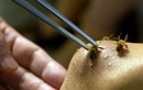 Vì sao bị ong vò vẽ đốt có thể tử vong sau 15 phút?