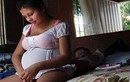 Phụ nữ nhiễm Zika cuối thai kỳ con không bị dị tật