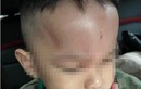 Đà Nẵng: Xác minh thông tin trẻ bị bạo hành ở trường mầm non
