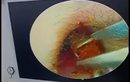 Đi khám, người đàn ông phát hiện “dị vật đáng sợ“