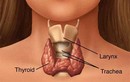 Có thể có con sau khi điều trị ung thư tuyến giáp