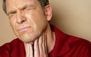 Phát hiện chủng virut làm tăng nguy cơ ung thư vòm họng