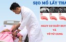 Sản phụ 40 tuổi thai bám ở sẹo mổ nguy hiểm tính mạng