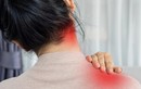 Vì sao nhiều người trẻ mắc chứng đau cổ vai gáy?