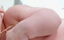 Bé gái chào đời mang theo vòng tránh thai của mẹ