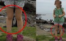 Bí ẩn “đôi chân ma” xuất hiện trong ảnh chụp bé gái