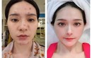 Lộ gương mặt chi chít lỗ “nữ đại gia quận 7“ làm netizen sợ