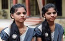 Ngôi làng kỳ lạ nhất Ấn Độ: 237 người ai cũng giống nhau