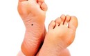 Bàn chân có 4 dấu hiệu này, đều hưởng phúc khí sâu