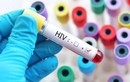 Điểm danh những yếu tố khiến việc điều trị HIV thất bại