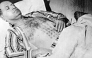 Chạm trán UFO, người đàn ông bị bỏng nặng, 32 năm không mờ vết