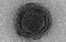  Virus 'thần nước 'mang bộ gene khiến giới khoa học sửng sốt