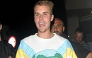 Justin Bieber xuất hiện với gương mặt phờ phạc đầy mụn