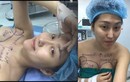 Rợn người quá trình đại phẫu 45 tiếng của Phi Thanh Vân