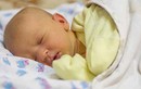 9 biện pháp khắc phục tại nhà cho vàng da ở trẻ sơ sinh