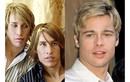 Anh em sinh đôi phẫu thuật để giống Brad Pitt và cái kết