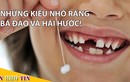 Video: Muôn kiểu nhổ răng bá đạo cho trẻ nhỏ