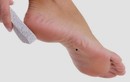 5 dấu hiệu "có của" ở bàn chân người phụ nữ