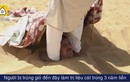 Video: Chôn mình trong cát dưới nắng 50 độ để chữa đột quỵ, nhức xương