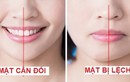 3 thói quen khiến khuôn mặt bị lệch, mất cân đối